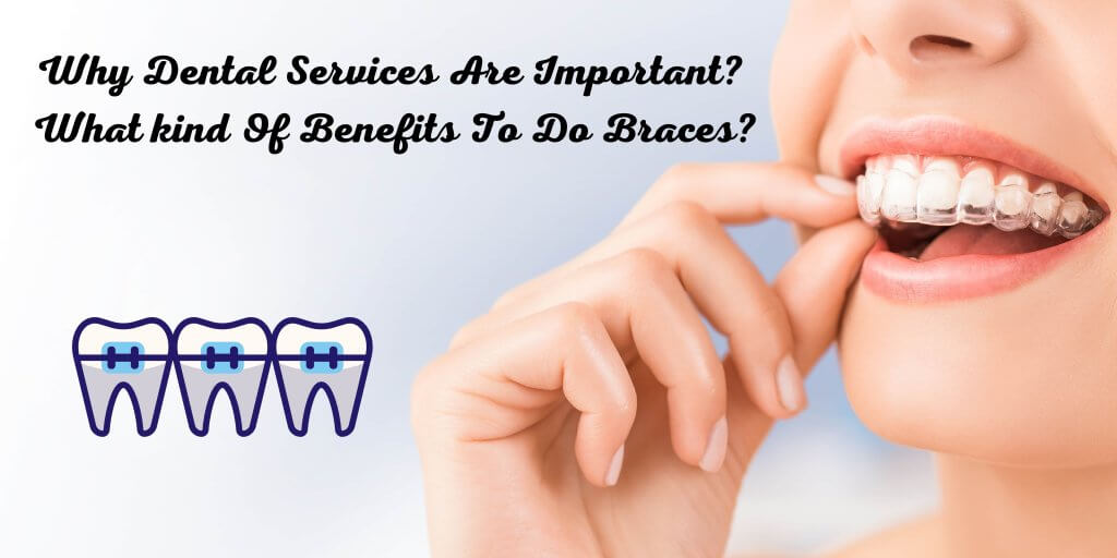 Why Dental Services Are Important? What kind Of Benefits To Do Braces?
