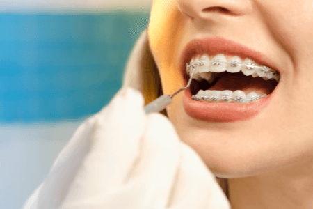 dental Care in dubai