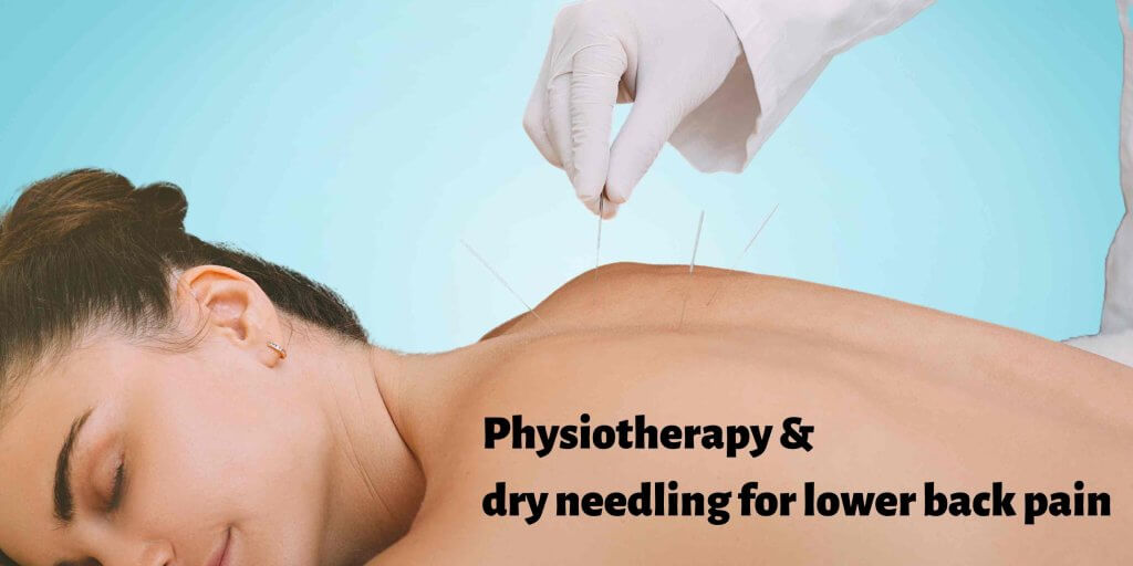 Best Physiotherapy in Dubai: Dry needling for lower back pain