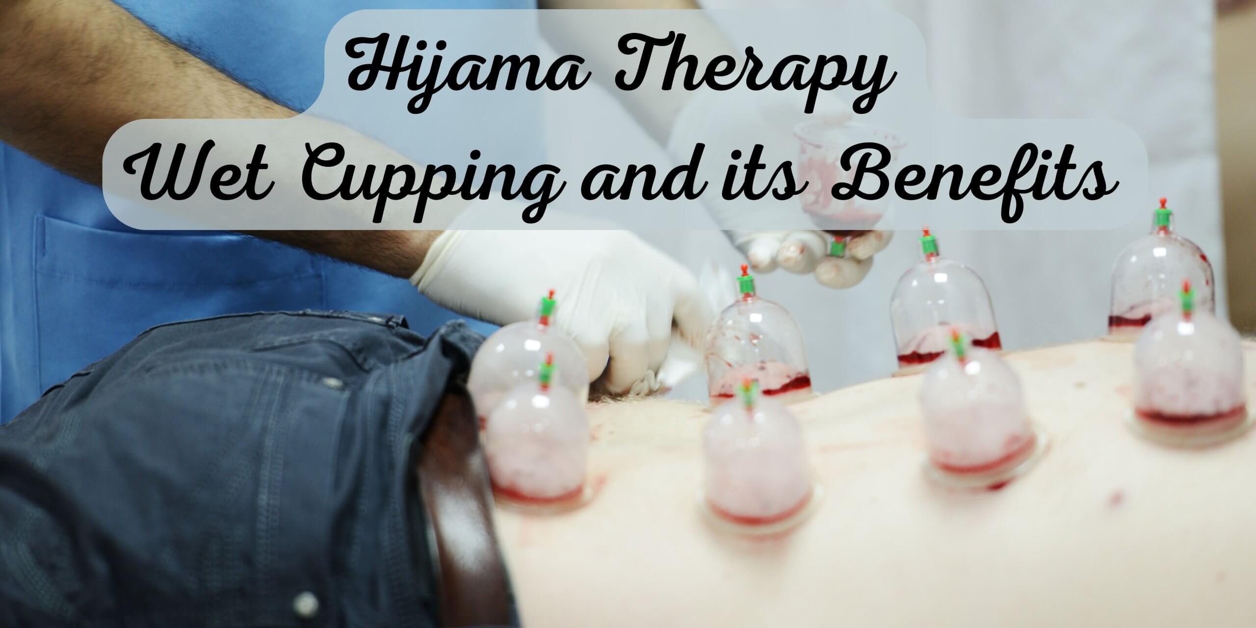 Hijama Therapy Wet Cupping And Its Benefits Yesmaam
