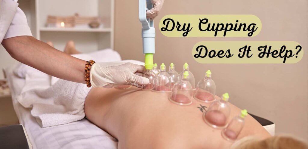 Dry Cupping: Does It Help?