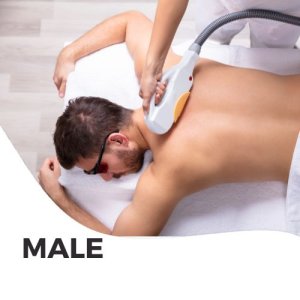 Fullbody laser hair removal for men